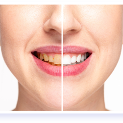 Natural Teeth Whitener – Mouth Detox Whitening System – Buy Online at AbmarketX