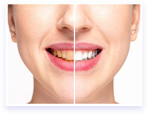 Natural Teeth Whitener – Mouth Detox Whitening System – Buy Online at AbmarketX