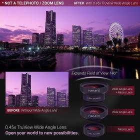 Xenvo Pro Lens Kit – LED Light & Travel Case – Buy Online at AbmarketX