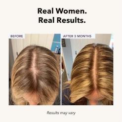 FullyVital Hair Serum – Formula for Thicker, Fuller Hair – Buy Online at AbmarketX
