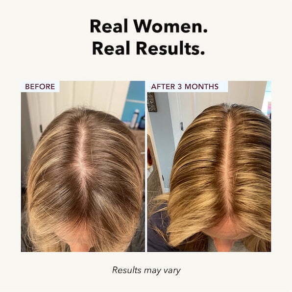 FullyVital Hair Serum – Formula for Thicker, Fuller Hair – Buy Online at AbmarketX
